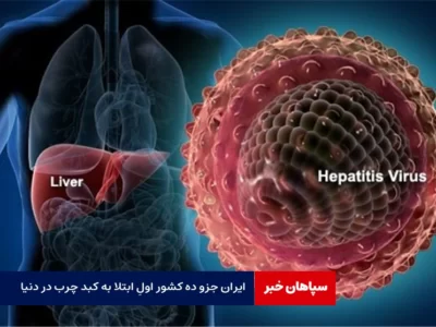  ایران جزو ده کشور اول ابتلا به کبد چرب در دنیا