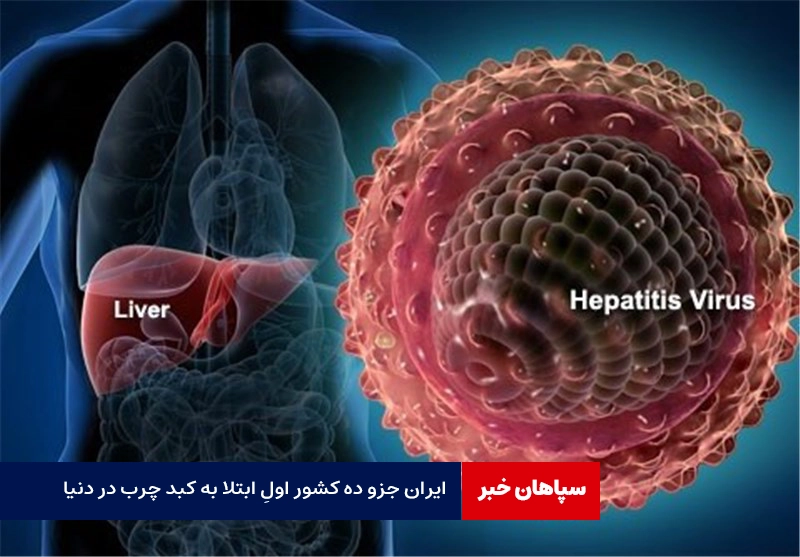  ایران جزو ده کشور اول ابتلا به کبد چرب در دنیا