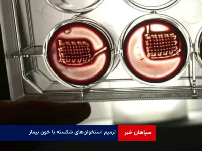 ترمیم استخوان‌ های شکسته با خون بیمار!