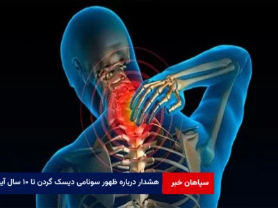هشدار جراح مغز و اعصاب درباره ظهور سونامی دیسک گردن تا ۱۰ سال آینده
