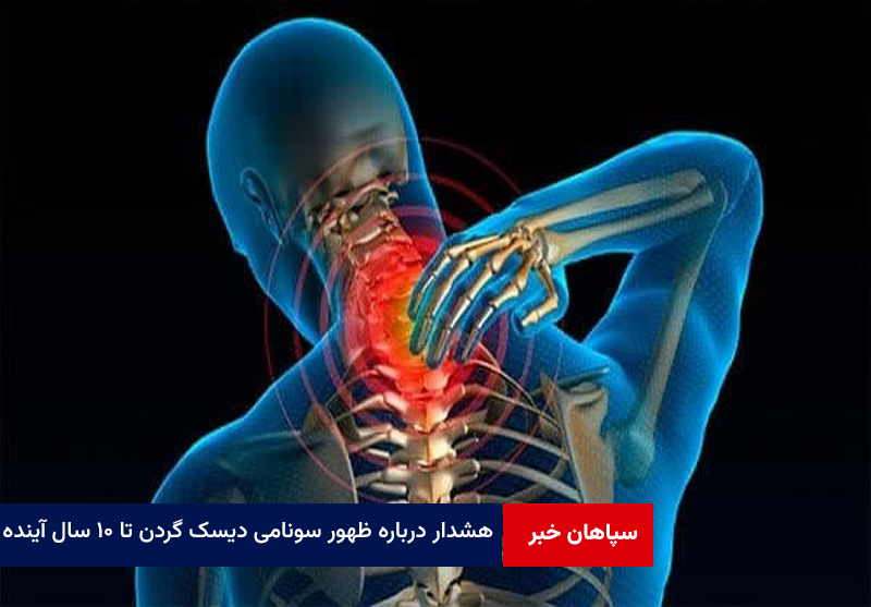 هشدار جراح مغز و اعصاب درباره ظهور سونامی دیسک گردن تا ۱۰ سال آینده