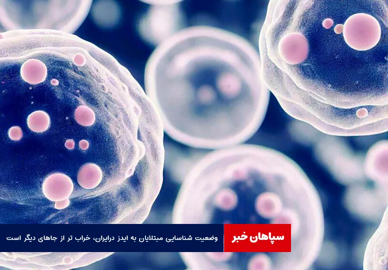 وضعیت شناسایی مبتلایان به ایدز در ایران، خراب تر از جاهای دیگر است
