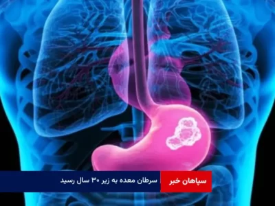 سرطان معده به زیر ۳۰ سال رسید