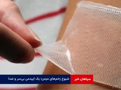 شیوع زخم‌ های مزمن؛ یک اپیدمی بی‌ سر و صدا