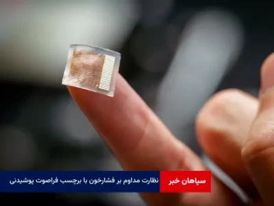 نظارت مداوم بر فشارخون با برچسب فراصوت پوشیدنی