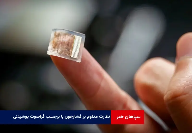 نظارت مداوم بر فشارخون با برچسب فراصوت پوشیدنی