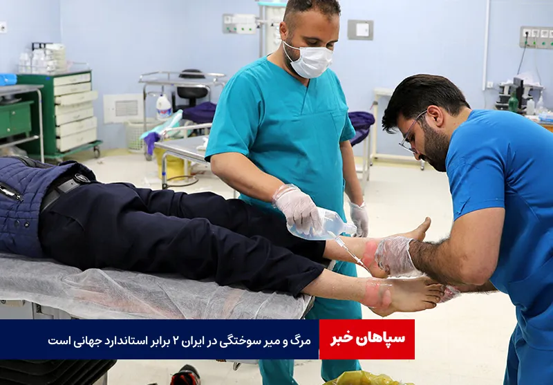 مرگ و میر سوختگی در ایران ۲ برابر استاندارد جهانی است