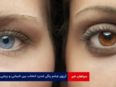 آرزوی چشم رنگی شدن؛ انتخاب بین نابینایی و زیبایی