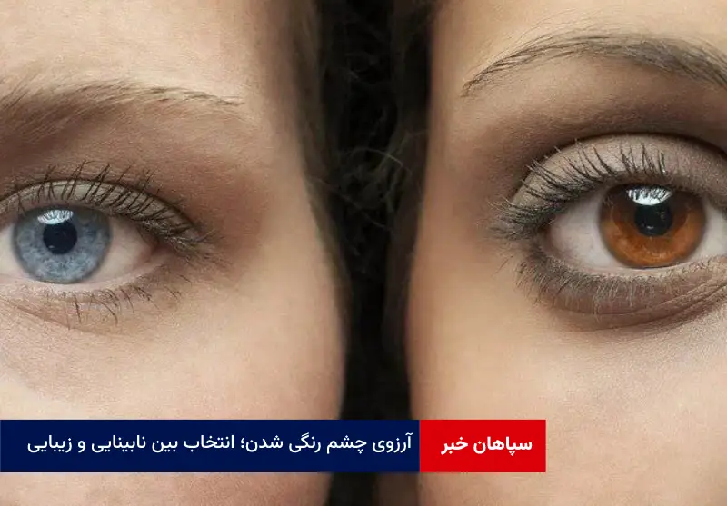 آرزوی چشم رنگی شدن؛ انتخاب بین نابینایی و زیبایی