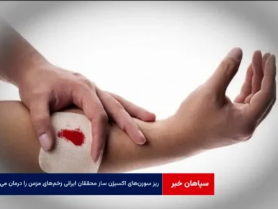 ریز سوزن‌های اکسیژن ساز محققان ایرانی زخم‌های مزمن را درمان می‌کند