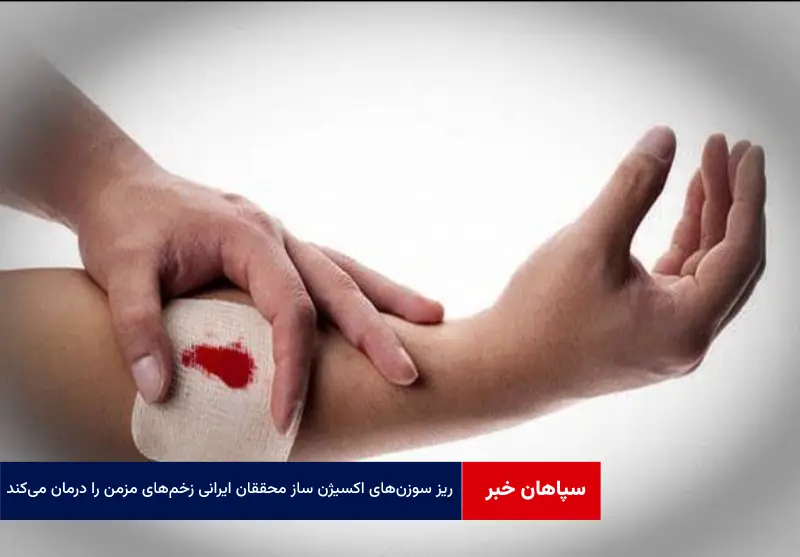ریز سوزن‌های اکسیژن ساز محققان ایرانی زخم‌های مزمن را درمان می‌کند