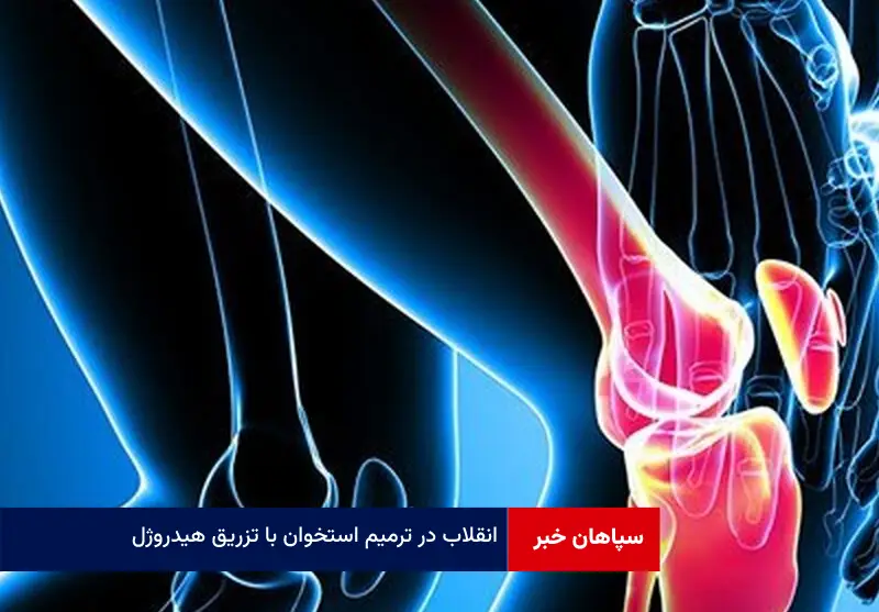انقلاب در ترمیم استخوان‌ با تزریق هیدروژل