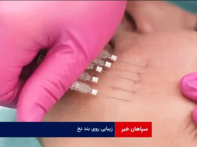 زیبایی روی بند نخ!