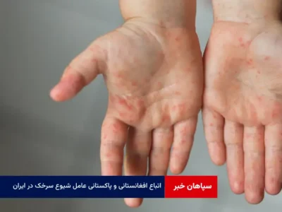 اتباع افغانستانی و پاکستانی عامل شیوع سرخک در ایران
