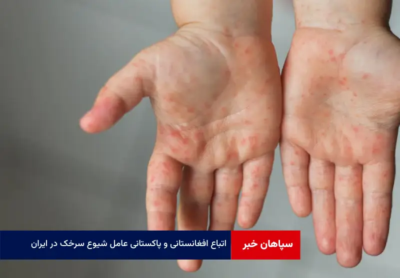 اتباع افغانستانی و پاکستانی عامل شیوع سرخک در ایران