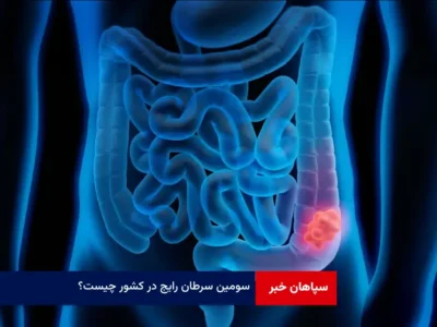 سومین سرطان رایج در کشور چیست؟