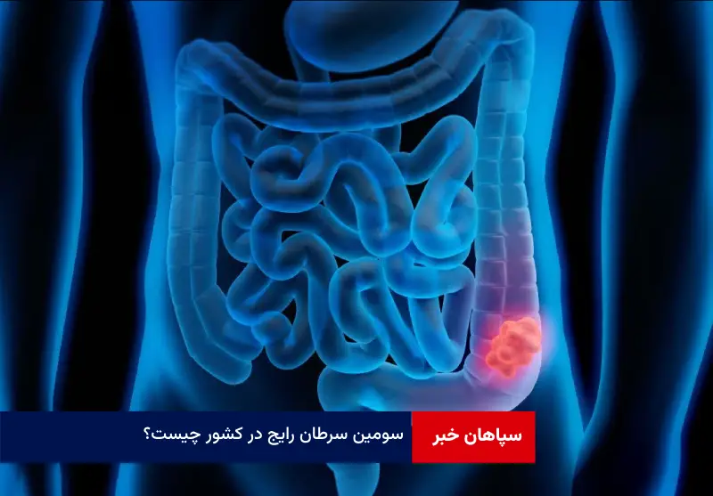 سومین سرطان رایج در کشور چیست؟