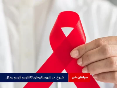 شیوع  در شهرستان‌های کاشان و آران و بیدگل پایین‌تر از متوسط کشور