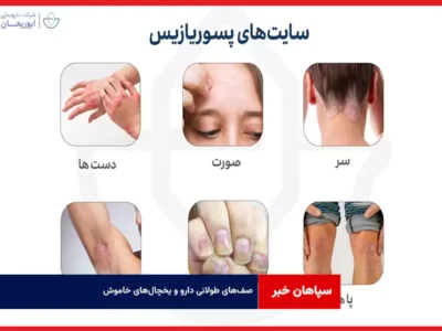 صف‌های طولانی دارو و یخچال‌های خاموش