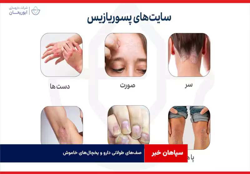 صف‌های طولانی دارو و یخچال‌های خاموش