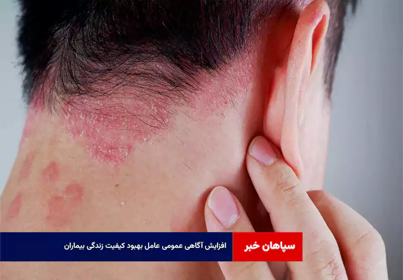 افزایش آگاهی عمومی عامل بهبود کیفیت زندگی بیماران