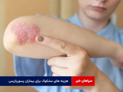 هزینه های مشکوک برای بیماران پسوریازیس