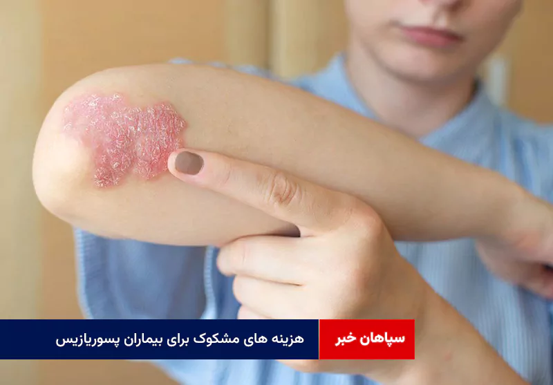 هزینه های مشکوک برای بیماران پسوریازیس
