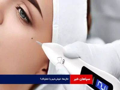 خال‌ها؛ خوش‌خیم یا خطرناک؟