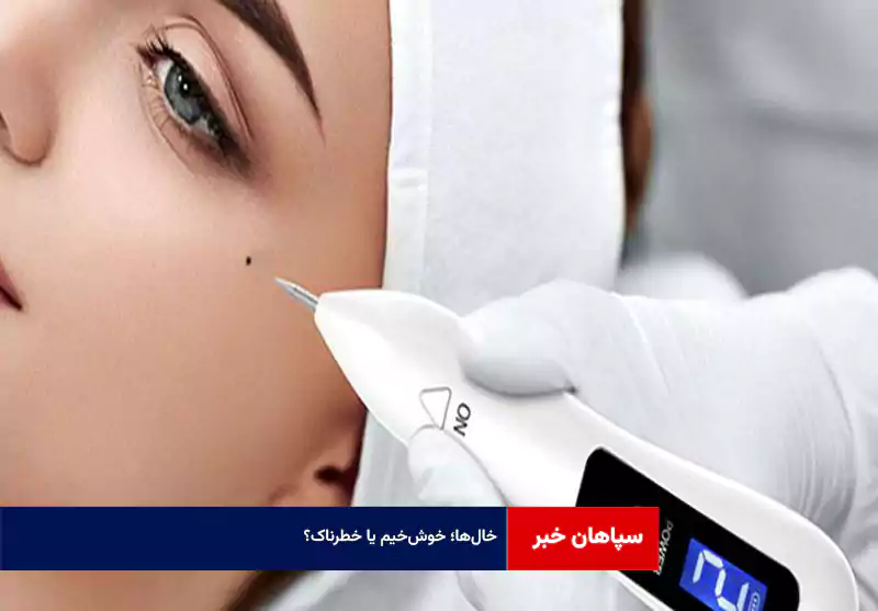 خال‌ها؛ خوش‌خیم یا خطرناک؟