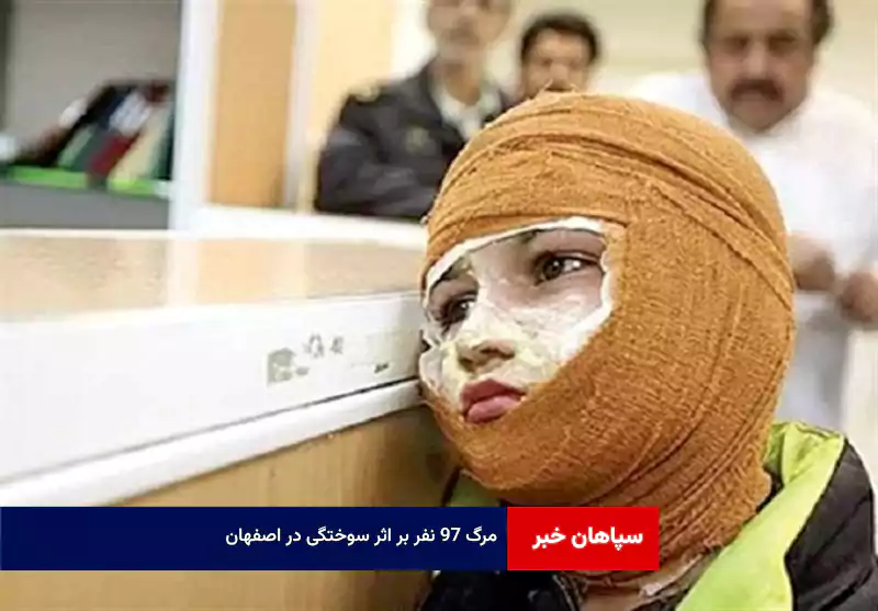 مرگ ۹۷ نفر بر اثر سوختگی در اصفهان