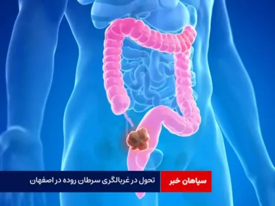 تحول در غربالگری سرطان روده در اصفهان