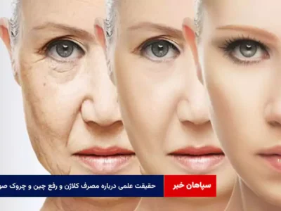 حقیقت علمی درباره مصرف کلاژن و رفع چین و چروک صورت