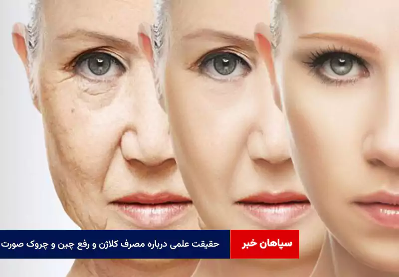 حقیقت علمی درباره مصرف کلاژن و رفع چین و چروک صورت