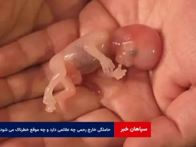 حاملگی خارج رحمی چه علائمی دارد و چه موقع خطرناک می شود؟