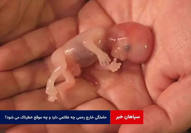 حاملگی خارج رحمی چه علائمی دارد و چه موقع خطرناک می شود؟