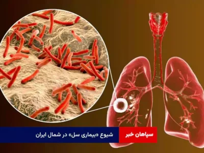 شیوع «بیماری سل» در شمال ایران