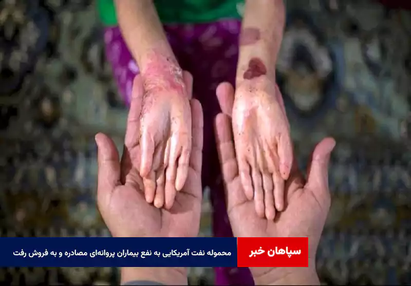 محموله نفت آمریکایی به نفع بیماران پروانهای مصادره و به فروش رفت
