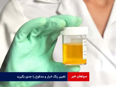 تغییر رنگ ادرار و مدفوع را جدی بگیرید