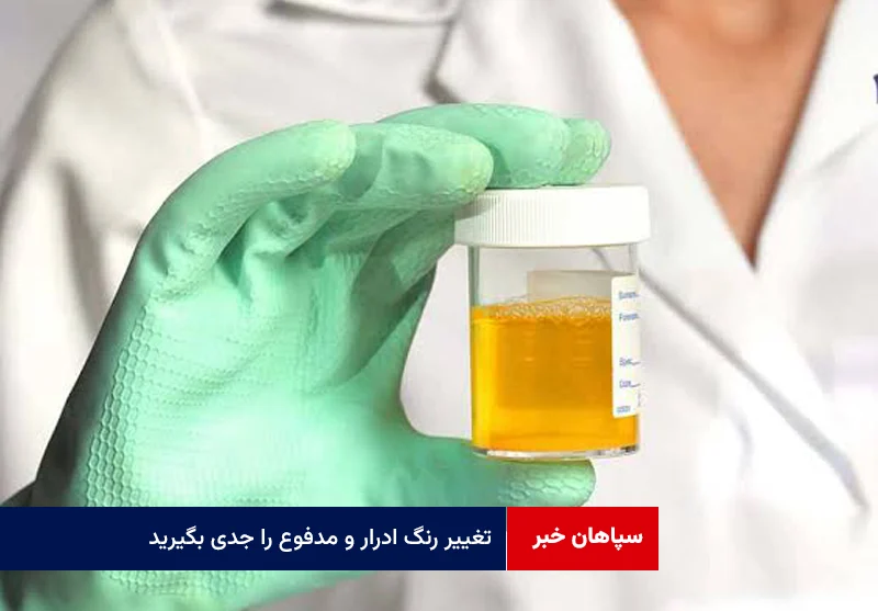 تغییر رنگ ادرار و مدفوع را جدی بگیرید