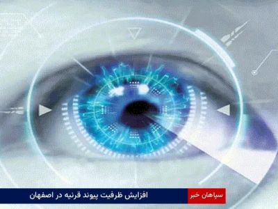 افزایش ظرفیت پیوند قرنیه در اصفهان